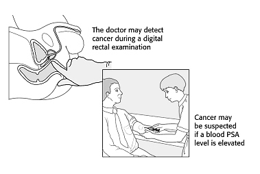 Figure 5: Digital rectal examination