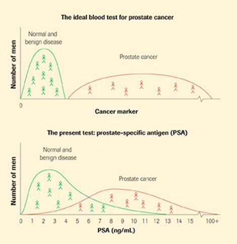 Blood testing for prostate cancer